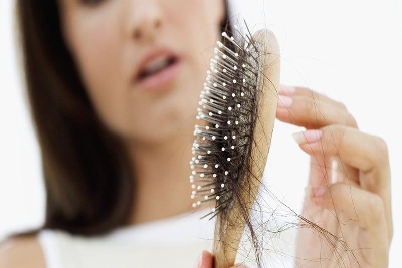Rụng tóc ở nam tuổi 20 do đâu, điều trị và chăm sóc thế nào?