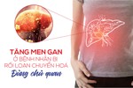 Men gan cao ở bệnh nhân rối loạn chuyển hoá – Đâu là nguyên nhân?