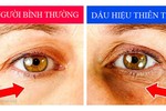 7 dấu hiệu nhận biết thiên tài cha mẹ cần đặc biệt lưu ý