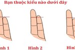 Đoán trước vận mệnh sang hèn thông qua ngón tay út