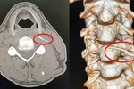 Uống "nước thần" của bà mo, bệnh nhân nhập viện khẩn cấp