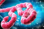 Vì sao Ebola là nỗi sợ khủng khiếp của nhân loại?