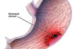 Giảm cân bằng rượu, phúc ít họa nhiều