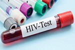 Virus giống HIV, nguy cơ lây sang người nguy hiểm sao?