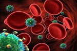 Bé sơ sinh thứ hai mắc HIV bẩm sinh được chữa khỏi