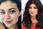 Mẫu trẻ Kylie Jenner lộ ảnh mặt mộc đầy tàn nhang