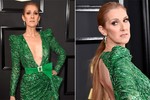 Celine Dion không giấu được vẻ già nua ở tuổi U50