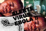 Tiết lộ bất ngờ về tên gọi virus Ebola 