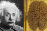 Bộ não của thiên tài Einstein được "mổ xẻ" thế nào? 