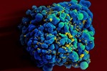 Phát hiện người thứ hai tự khỏi HIV