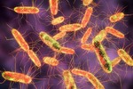 80 sinh viên ở Lào Cai ngộ độc, “thủ phạm“ là vi khuẩn Salmonella