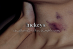 Hickey Kiss, trào lưu hôn rợn người của các cặp đôi