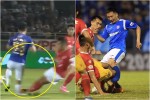 Trước Đỗ Hùng Dũng, V-League từng chứng kiến bao vụ gẫy chân?