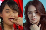 Hành trình "đổi đời" của "thánh sún" mất 9 cái răng