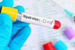 Virus Nipah bùng phát, tỷ lệ tử vong tới 75%