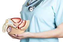 4 dấu hiệu tổn thương tuyến tiền liệt
