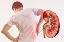 Dấu hiệu cảnh báo sớm bệnh suy thận, chớ chủ quan