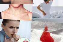 Dấu hiệu cảnh báo bệnh ung thư không được chủ quan