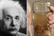 Bác sĩ “điên rồ” nào cả gan đánh cắp bộ não của thiên tài Einstein? 