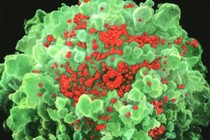 Vaccine AIDS giúp 5 bệnh nhân ‘sạch’ HIV trong 7 tháng