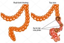 Thuốc chữa bệnh tiêu hóa gây hại... đường tiêu hóa