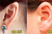 Một người sở hữu tướng tai này: Cả đời bị Thần Tài bỏ rơi