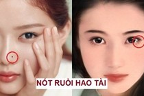 5 nốt ruồi hao tài phá lộc khiến chủ nhân dễ tán gia bại sản