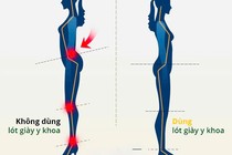 Chọn giày dép đúng cách tránh bệnh cột sống