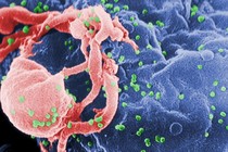 Sắp có que cấy dưới da chống HIV