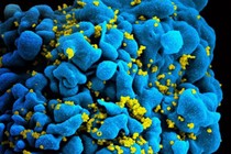 Hai bệnh nhân tự ức chế virus HIV sau khi ngừng dùng thuốc điều trị