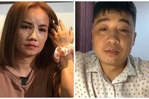 Chồng cũ livestream nói lý do đấm gãy mũi Hoàng Yến