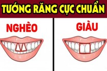 Dù nam hay nữ nếu sở hữu 4 tướng răng này thường nghèo khổ, tình duyên lận đận