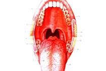 8 phương pháp chẩn đoán ung thư mũi họng