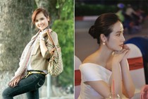 Huyền Lizzie thăng hạng nhan sắc sau khi sửa mũi