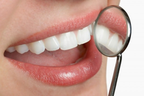 7 bệnh về răng miệng thường gặp, cần đặc biệt chú ý
