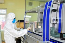 CDC Hà Nội thổi giá máy xét nghiệm COVID-19: Thanh tra, minh bạch là cần thiết