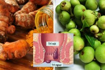 Bài thuốc chữa trĩ từ nghệ tươi, diếp cá và quả sung