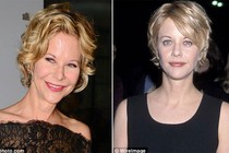 Khuôn mặt của Meg Ryan ngày càng biến dạng