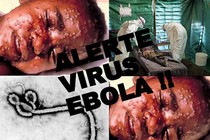 Tiết lộ bất ngờ về tên gọi virus Ebola 