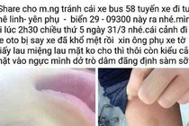 Sa thải phụ xe buýt tát nữ sinh thâm tím mặt