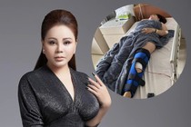 Diễn viên Lê Giang phải nhập viện mổ chân