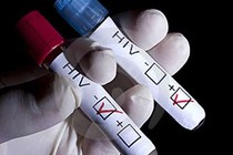 Lần đầu tiên áp dụng tự xét nghiệm HIV tại Việt Nam