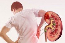 Chế độ ăn cho người suy thận 