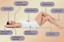 9 dấu vết xấu xí trên cơ thể chứng tỏ bạn có bệnh 