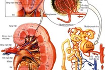 Suy thượng thận do dùng thuốc corticoid chữa dị ứng, viêm khớp