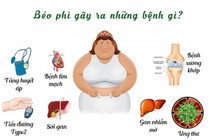 Thừa cân, béo phì gây nhiều bệnh xương khớp