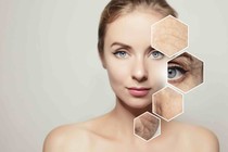 Bác sĩ chỉ rõ cách chống lão hóa da sớm
