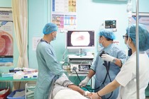 vỡ tĩnh mạch thực quản, xuất huyết tiêu hóa, xơ gan