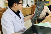 Khi phát hiện u gan đã to khổng lồ: 14 cm
