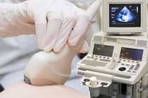 Sàng lọc ung thư, bệnh mạn tính có được thanh toán bảo hiểm y tế?